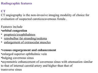 Radiographic features
CT
CT angiography is the non-invasive imaging modality of choice for
evaluation of suspected caroticocavernous fistula .
Features include
•orbital congestion
• proptosis/exophthalmos
• retrobulbar fat stranding/oedema
• enlargement of extraocular muscles
•venous engorgement and enhancement
•enlarged superior ophthalmic vein
•bulging cavernous sinus
•asymmetric enhancement of cavernous sinus with attenuation similar
to that of internal carotid artery and higher than that of
transverse sinus
 