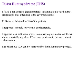 Tolosa Hunt syndrome (THS)
THS is a non-specific granulomatous inflammation located in the
orbital apex and extending to the cavernous sinus.
THS can be bilateral in 5% of the patients.
It responds strongly to systemic corticosteroid.
It appears as a soft tissue mass, isointense to gray matter on T1-wi.
shows a variable signal on T2-wi and moderate to intense contrast
enhancement.
The cavernous ICA can be narrowed by the inflammatory process.
 
