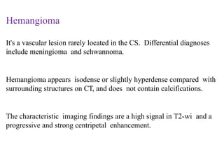 Hemangioma
It's a vascular lesion rarely located in the CS. Differential diagnoses
include meningioma and schwannoma.
Hemangioma appears isodense or slightly hyperdense compared with
surrounding structures on CT, and does not contain calcifications.
The characteristic imaging findings are a high signal in T2-wi and a
progressive and strong centripetal enhancement.
 