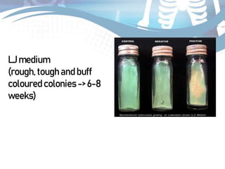 Tuberculosis diagnosis and investigations.pptx