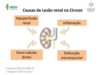 Causas de Lesão renal na Cirrose
J Hepatol 2015;62:968-74
J Hepatol 2019 in press
Hipoperfusão
renal Inflamação
Dano tubular
direto
Disfunção
microvascular
 