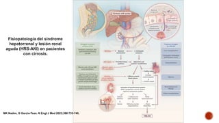 Fisiopatología del síndrome
hepatorrenal y lesión renal
aguda (HRS-AKI) en pacientes
con cirrosis.
MK Nadim, G Garcia-Tsao. N Engl J Med 2023;388:733-745.
 