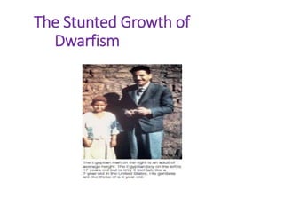 The Stunted Growth of
Dwarfism
 