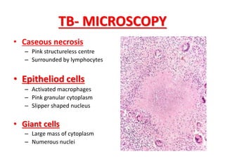 • Caseous necrosis
– Pink structureless centre
– Surrounded by lymphocytes
• Epitheliod cells
– Activated macrophages
– Pink granular cytoplasm
– Slipper shaped nucleus
• Giant cells
– Large mass of cytoplasm
– Numerous nuclei
TB- MICROSCOPY
 