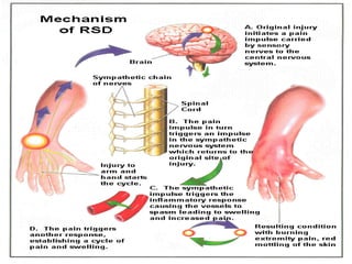 Hand Somatic Dysfunction Shoulder hand Syndrome in ortho bkk.pptx
