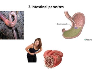 3.Intestinal parasites
 