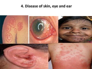 4. Disease of skin, eye and ear
 