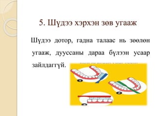 5. Шүдээ хэрхэн зөв угааж
Шүдээ дотор, гадна талаас нь зөөлөн
угааж, дууссаны дараа бүлээн усаар
зайлдаггүй.
 