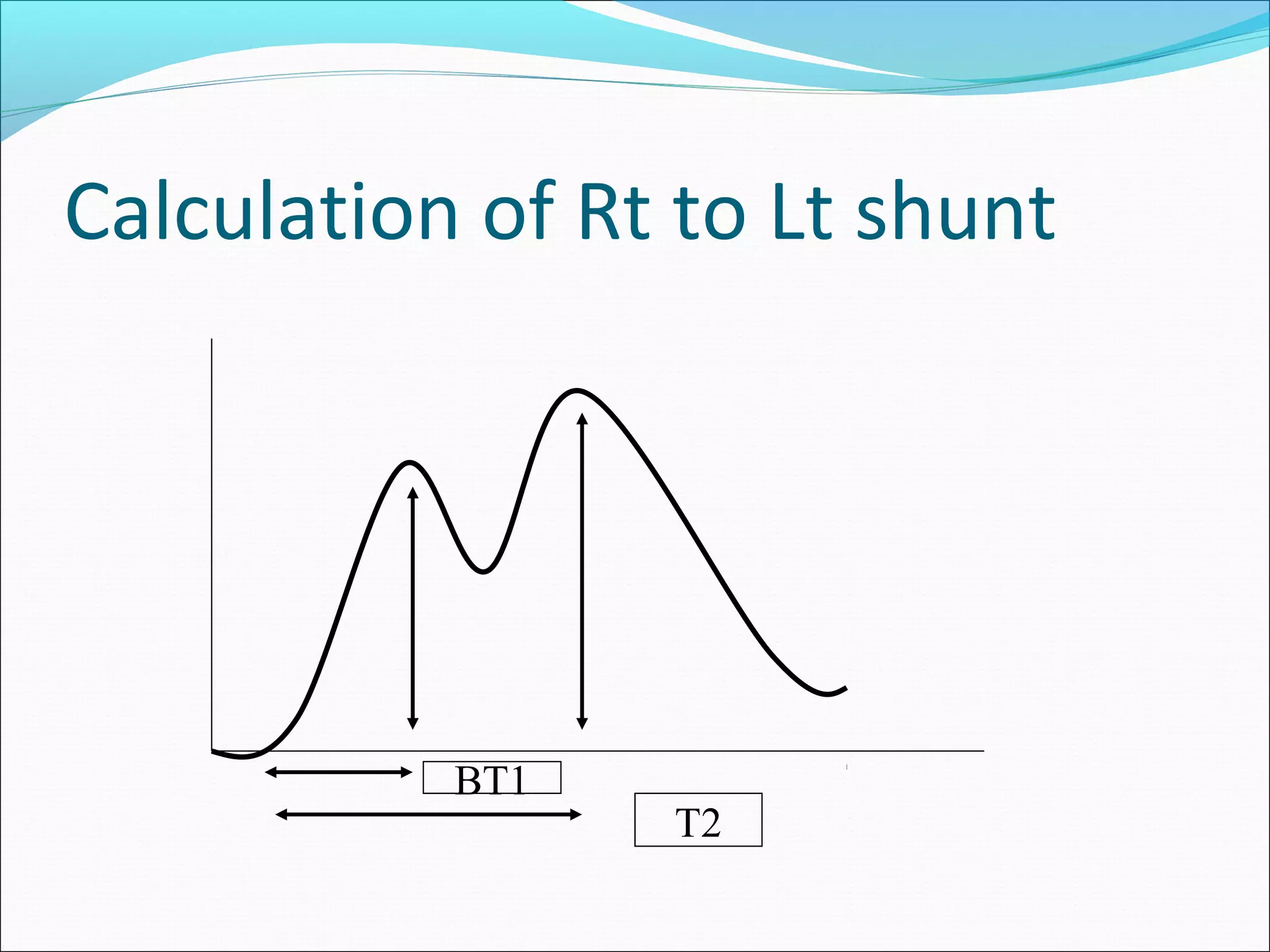 Calculation of Rt to Lt shunt
BT1
T2
 