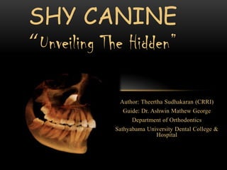 SHY CANINE
“Unveiling The Hidden”

Author: Theertha Sudhakaran (CRRI)
Guide: Dr. Ashwin Mathew George
Department of Orthodontics
Sathyabama University Dental College &
Hospital

 
