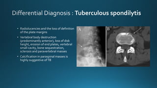 Bone Hydatid Disease