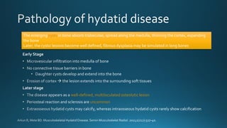 well-defined, multiloculated osteolytic lesion
uncommon
The enlarging cysts in bone absorb trabeculae, spread along the medulla, thinning the cortex, expanding
the bone
Later, the cystic lesions become well defined, fibrous dysplasia may be simulated in long bones
 