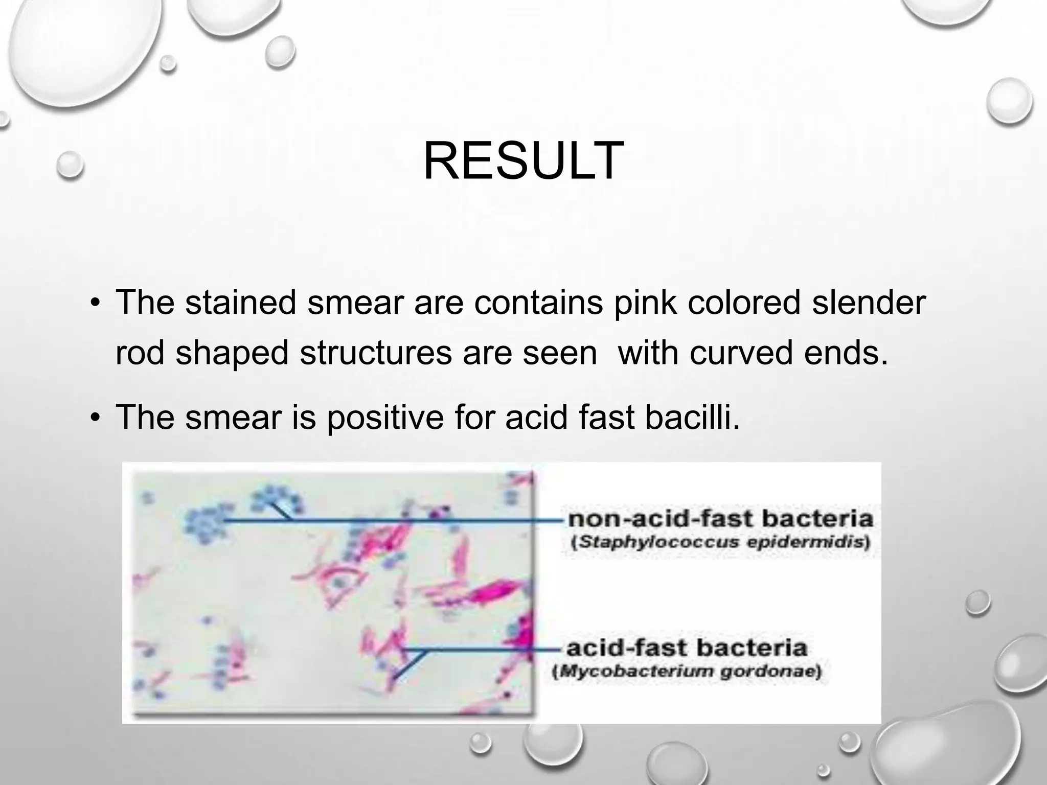 RESULT
• The stained smear are contains pink colored slender
rod shaped structures are seen with curved ends.
• The smear is positive for acid fast bacilli.
 