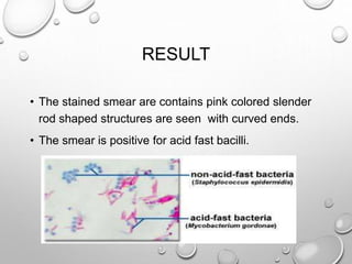 RESULT
• The stained smear are contains pink colored slender
rod shaped structures are seen with curved ends.
• The smear is positive for acid fast bacilli.
 