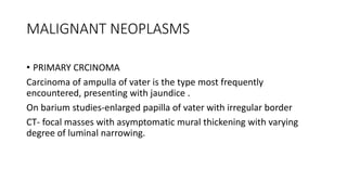 MALIGNANT NEOPLASMS
• PRIMARY CRCINOMA
Carcinoma of ampulla of vater is the type most frequently
encountered, presenting with jaundice .
On barium studies-enlarged papilla of vater with irregular border
CT- focal masses with asymptomatic mural thickening with varying
degree of luminal narrowing.
 