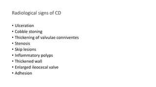 Radiological signs of CD
• Ulceration
• Cobble stoning
• Thickening of valvulae conniventes
• Stenosis
• Skip lesions
• Inflammatory polyps
• Thickened wall
• Enlarged ileocecal valve
• Adhesion
 