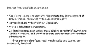 Imaging features of adenocarcinoma
• Apple core lesions-annular tumors manifested by short segment of
circumferential narrowing with mucosal irregularity.
• Polypoidal mass with or without ulceration.
• Multiple lobulated filling defects.
• CT- heterogenous attenuation mass causing concentric/ asymmetric
luminal narrowing and shows moderate enhancement after contrast
administration,
-liver, peritoneal surfaces, local lymph nodes and ovaries are
secondarily involved.
 