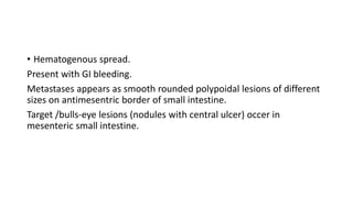 • Hematogenous spread.
Present with GI bleeding.
Metastases appears as smooth rounded polypoidal lesions of different
sizes on antimesentric border of small intestine.
Target /bulls-eye lesions (nodules with central ulcer) occer in
mesenteric small intestine.
 