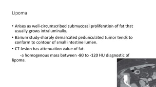 Lipoma
• Arises as well-circumscribed submucosal proliferation of fat that
usually grows intraluminally.
• Barium study-sharply demarcated pedunculated tumor tends to
conform to contour of small intestine lumen.
• CT-lesion has attenuation value of fat.
-a homogenous mass between -80 to -120 HU diagnostic of
lipoma.
 