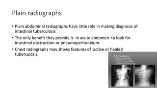 Plain radiographs
• Plain abdominal radiographs have little role in making diagnosis of
intestinal tuberculosis
• The only benefit they provide is in acute abdomen to look for
intestinal obstruction or pneumoperitoneium.
• Chest radiographs may shows features of active or healed
tuberculosis.
 