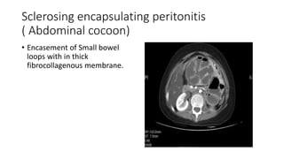 Sclerosing encapsulating peritonitis
( Abdominal cocoon)
• Encasement of Small bowel
loops with in thick
fibrocollagenous membrane.
 