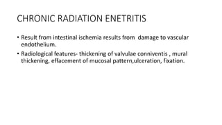CHRONIC RADIATION ENETRITIS
• Result from intestinal ischemia results from damage to vascular
endothelium.
• Radiological features- thickening of valvulae conniventis , mural
thickening, effacement of mucosal pattern,ulceration, fixation.
 