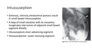 Intussuseption
• Extrensic, intrinsic,intraluminal process result
in small bowel intussuseption.
• A loop of small intestine with its mesentry
invaginates into lumen of adjacent small bowel
segment distally.
• Intussuseptum-inner advancing segment.
• Intussuscipience –outer receiving segment.
 