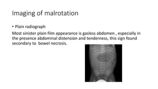 Imaging of malrotation
• Plain radiograph
Most sinister plain film appearance is gasless abdomen , especially in
the presence abdominal distension and tenderness, this sign found
secondary to bowel necrosis.
 