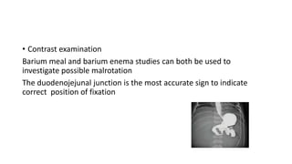 • Contrast examination
Barium meal and barium enema studies can both be used to
investigate possible malrotation
The duodenojejunal junction is the most accurate sign to indicate
correct position of fixation
 