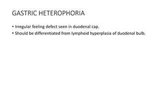 GASTRIC HETEROPHORIA
• Irregular feeling defect seen in duodenal cap.
• Should be differentiated from lymphoid hyperplasia of duodenal bulb.
 