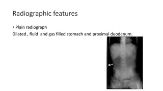Radiographic features
• Plain radiograph
Dilated , fluid and gas filled stomach and proximal duodenum.
 