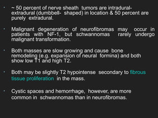 Radiology spinal cord tumors classification | PPTX