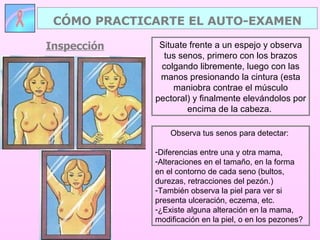 Situate frente a un espejo y observa tus senos, primero con los brazos colgando libremente, luego con las manos presionando la cintura (esta maniobra contrae el músculo pectoral) y finalmente elevándolos por encima de la cabeza.  Observa tus senos para detectar:  Diferencias entre una y otra mama, Alteraciones en el tamaño, en la forma  en el contorno de cada seno (bultos, durezas, retracciones del pezón.) También observa la piel para ver si presenta ulceración, eczema, etc.  ¿Existe alguna alteración en la mama, modificación en la piel, o en los pezones? CÓMO PRACTICARTE EL AUTO-EXAMEN Inspección 
