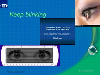 Keep blinking Making Dry Eyes Wet 