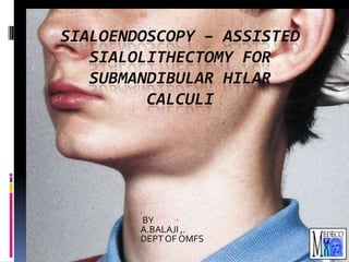 SIALOENDOSCOPY – ASSISTED
SIALOLITHECTOMY FOR
SUBMANDIBULAR HILAR
CALCULI

BY
A.BALAJI ,.
DEPT OF OMFS

 