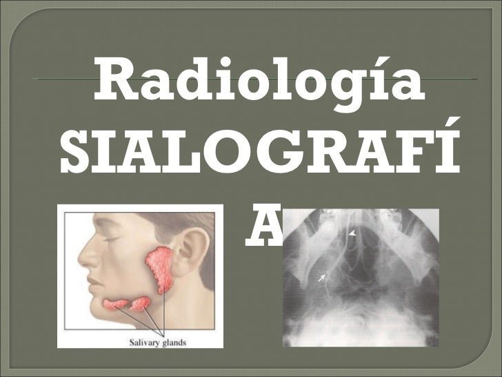 Sialografia
