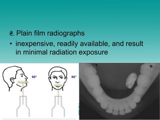 ₴. Plain film radiographs
• inexpensive, readily available, and result
in minimal radiation exposure
 