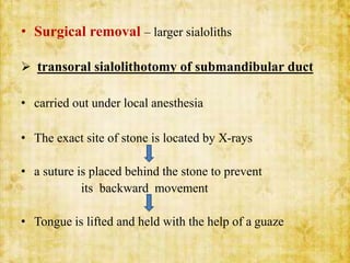 • Surgical removal – larger sialoliths
 transoral sialolithotomy of submandibular duct
• carried out under local anesthesia
• The exact site of stone is located by X-rays
• a suture is placed behind the stone to prevent
its backward movement
• Tongue is lifted and held with the help of a guaze
 