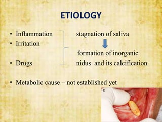 ETIOLOGY
• Inflammation stagnation of saliva
• Irritation
formation of inorganic
• Drugs nidus and its calcification
• Metabolic cause – not established yet
 