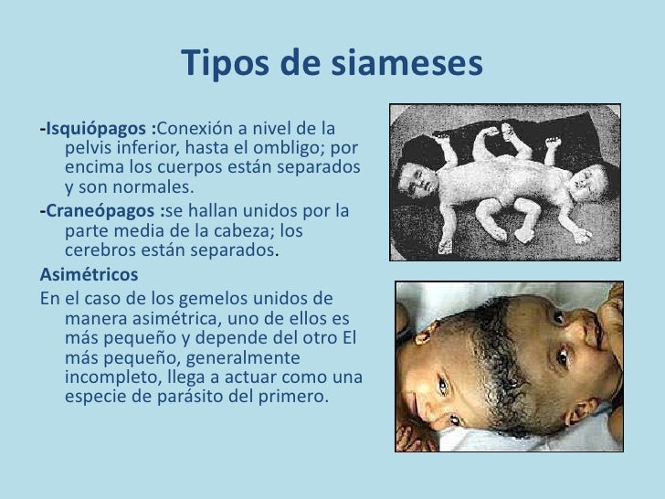 Siameses