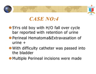 CASE NO:4 
5Yrs old boy with H/O fall over cycle 
bar reported with retention of urine 
Perineal HematomaExtravasation of 
urine + 
With difficulty catheter was passed into 
the bladder 
Multiple Perineal incisions were made 
 