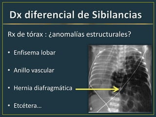Rx de tórax : ¿anomalías estructurales?
• Enfisema lobar
• Anillo vascular
• Hernia diafragmática
• Etcétera…
 