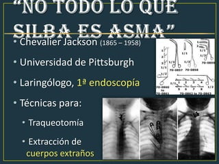 • Chevalier Jackson (1865 – 1958)
• Universidad de Pittsburgh
• Laringólogo, 1ª endoscopía
• Técnicas para:
• Traqueotomía
• Extracción de
cuerpos extraños
 