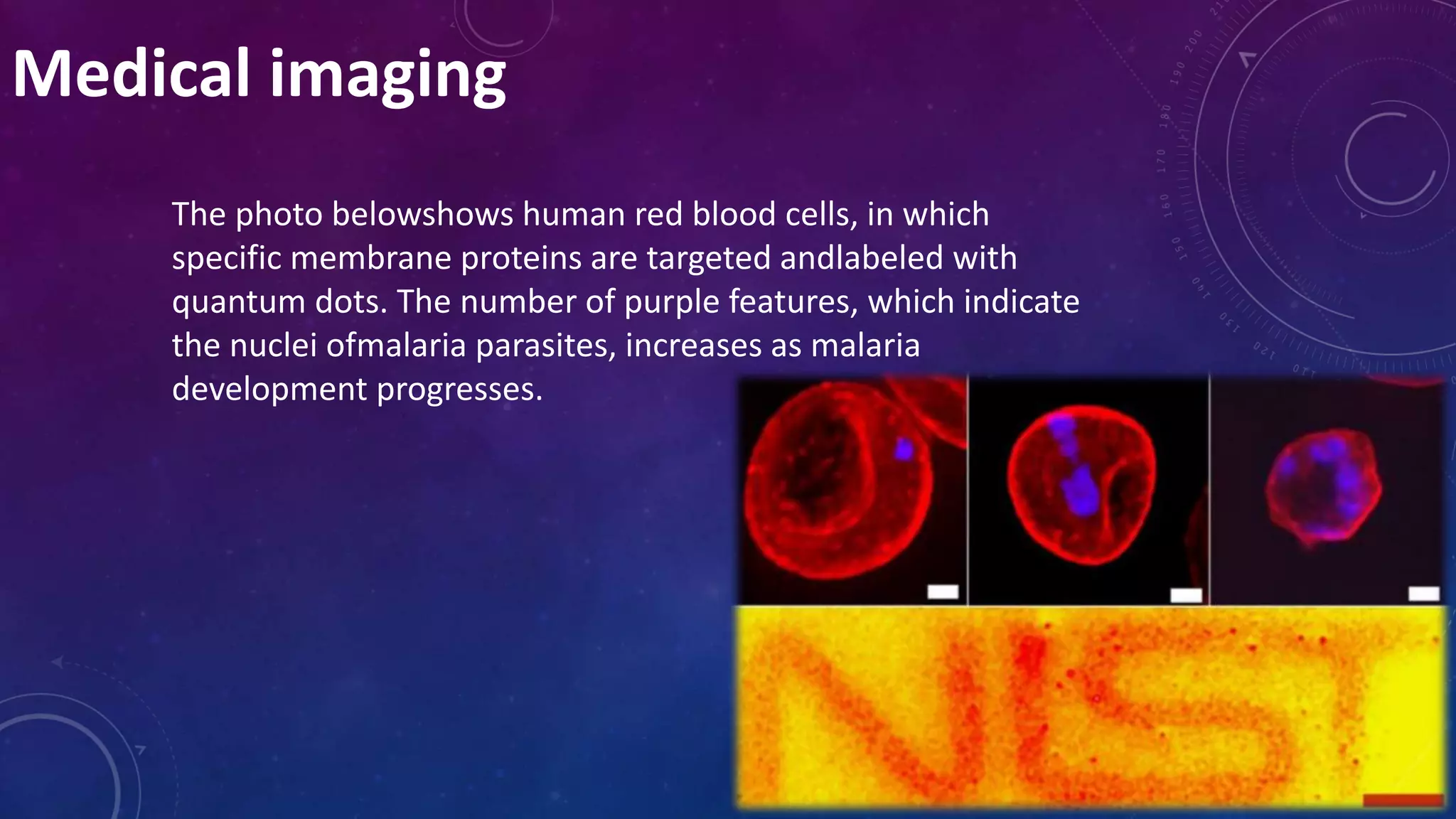 Medical imaging
The photo belowshows human red blood cells, in which
specific membrane proteins are targeted andlabeled with
quantum dots. The number of purple features, which indicate
the nuclei ofmalaria parasites, increases as malaria
development progresses.
 