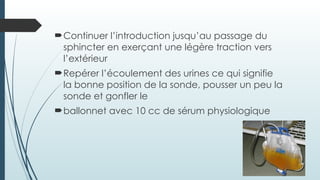 Continuer l’introduction jusqu’au passage du
sphincter en exerçant une légère traction vers
l’extérieur
Repérer l’écoulement des urines ce qui signifie
la bonne position de la sonde, pousser un peu la
sonde et gonfler le
ballonnet avec 10 cc de sérum physiologique
 