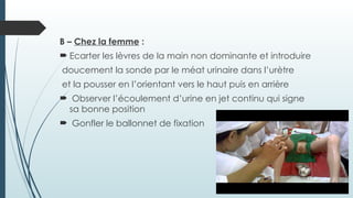 B – Chez la femme :
 Ecarter les lèvres de la main non dominante et introduire
doucement la sonde par le méat urinaire dans l’urètre
et la pousser en l’orientant vers le haut puis en arrière
 Observer l’écoulement d’urine en jet continu qui signe
sa bonne position
 Gonfler le ballonnet de fixation
 