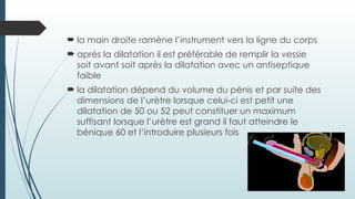  la main droite ramène l’instrument vers la ligne du corps
 après la dilatation il est préférable de remplir la vessie
soit avant soit après la dilatation avec un antiseptique
faible
 la dilatation dépend du volume du pénis et par suite des
dimensions de l’urètre lorsque celui-ci est petit une
dilatation de 50 ou 52 peut constituer un maximum
suffisant lorsque l’urètre est grand il faut atteindre le
bénique 60 et l’introduire plusieurs fois
 