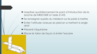  Aseptiser quotidiennement le point d’introduction de la
broche de KIRSCNER à l’aide d’ATS
 Se renseigner auprès du médecin sur le poids à mettre
 Eviter l’attitude vicieuse du pied en a mettant à angle
droit
 Prévenir l’équinisme
 Placer le talon de façon à éviter l’escarre
 