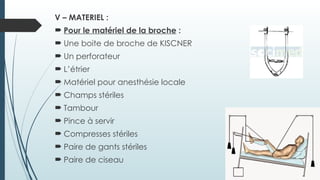 V – MATERIEL :
 Pour le matériel de la broche :
 Une boite de broche de KISCNER
 Un perforateur
 L’étrier
 Matériel pour anesthésie locale
 Champs stériles
 Tambour
 Pince à servir
 Compresses stériles
 Paire de gants stériles
 Paire de ciseau
 