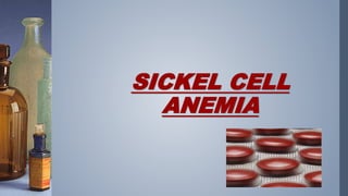 SICKEL CELL
ANEMIA
 